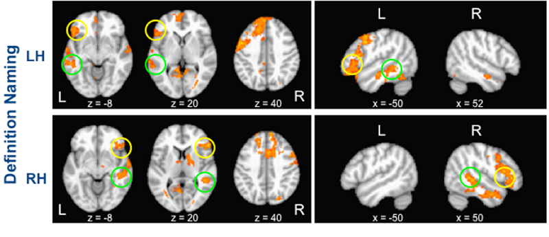 image showing multi brain scans. 